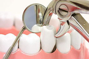 Extractions